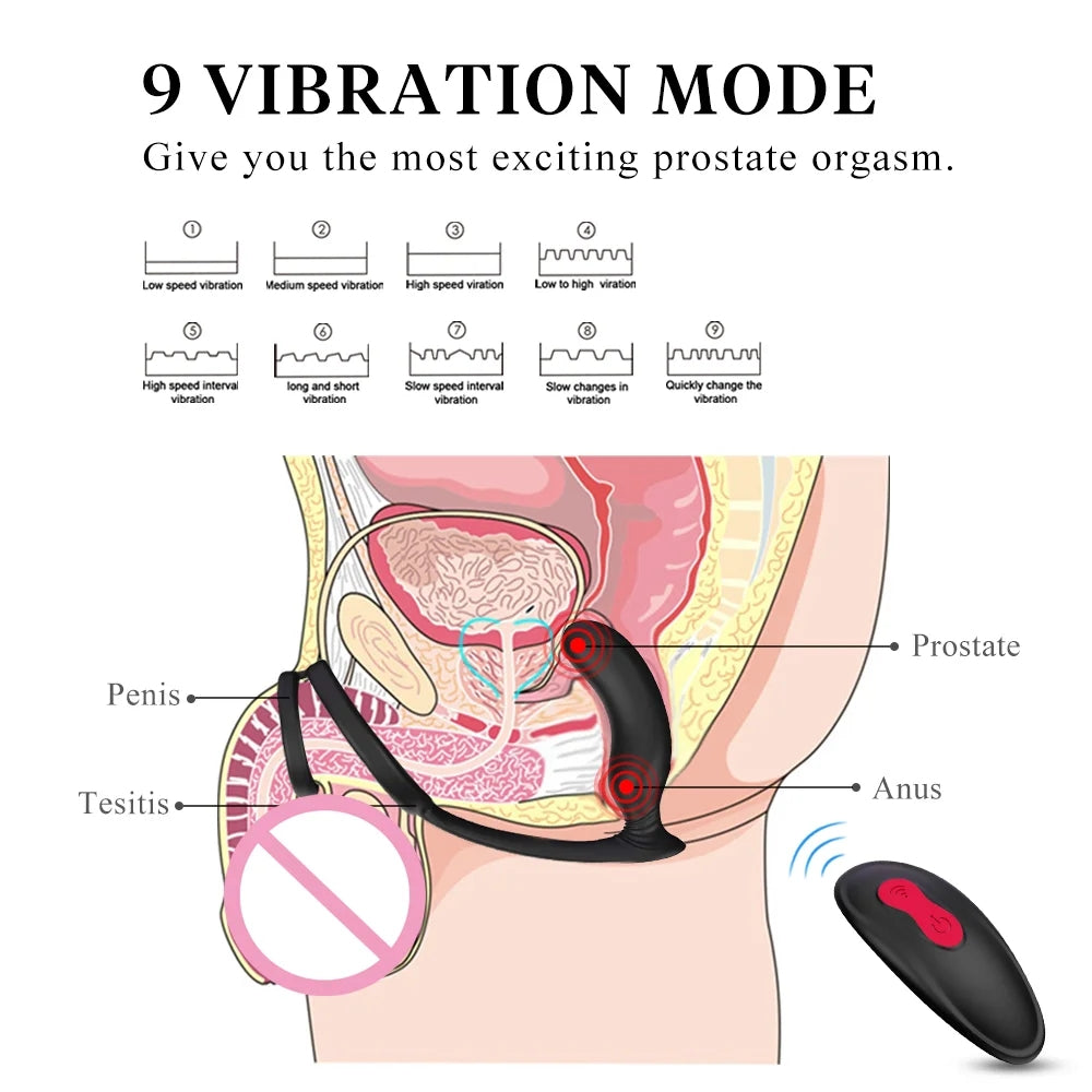 Siren - Wireless Remote Control Rotating Beads Vibrating Prostate Mass ZhenDuo Sex Shop Siren - Wireless Remote Control Rotating Beads Vibrating Prostate Mass ZhenDuo Sex Shop